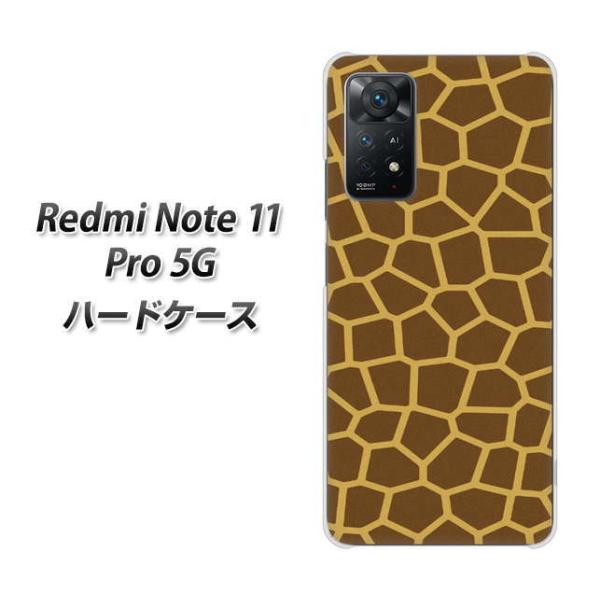 SIM�t���[ Xiaomi Redmi Note 11 Pro 5G �n�[�h�P�[�X VA886 �L������ �f�ރN���A UV���