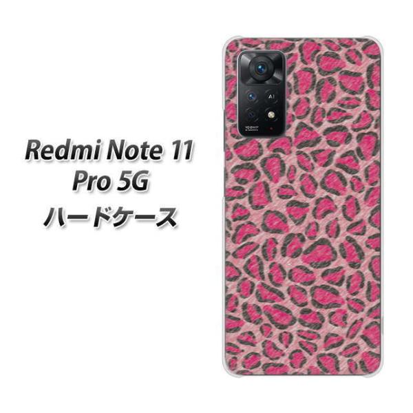 SIM�t���[ Xiaomi Redmi Note 11 Pro 5G �n�[�h�P�[�X VA893 �f�U�C���q���E�� �_���[�W�s���N �f�ރN���A UV���