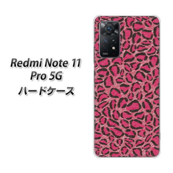 SIMt[ Xiaomi Redmi Note 11 Pro 5G n[hP[X VA894 fUCqE sN fރNA UV