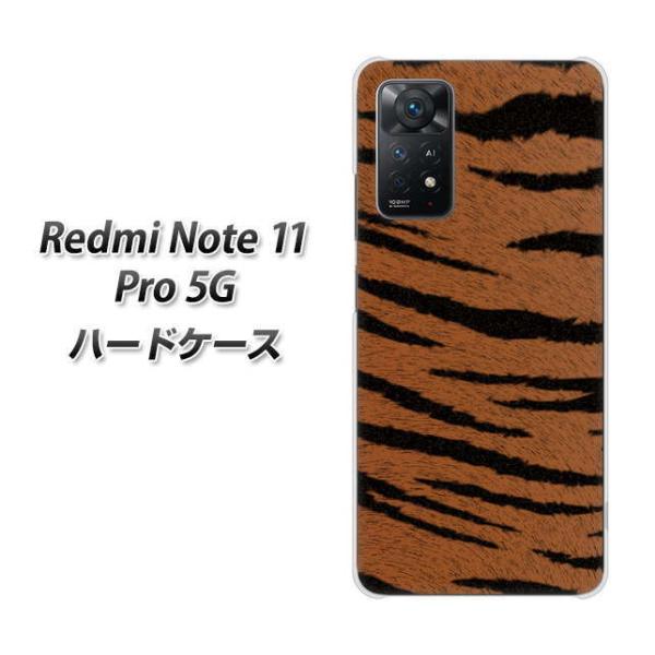 SIM�t���[ Xiaomi Redmi Note 11 Pro 5G �n�[�h�P�[�X VA897 �g���� �u���E�� �f�ރN���A UV���
