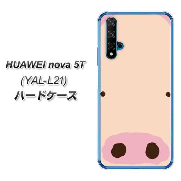 t@[EFC nova 5T YAL-L21 n[hP[X Jo[ 353 Ԃ fރNA UV