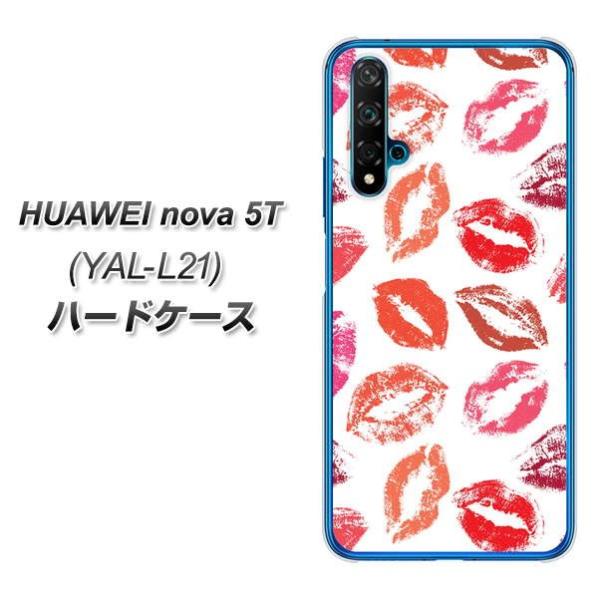 �t�@�[�E�F�C nova 5T YAL-L21 �n�[�h�P�[�X �J�o�[ 734 �L�Xkiss�L�X �f�ރN���A UV���