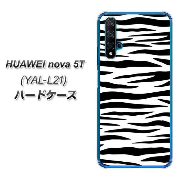 �t�@�[�E�F�C nova 5T YAL-L21 �n�[�h�P�[�X �J�o�[ VA891 �[�u�� �z���C�g×�u���b�N �f�ރN���A UV���
