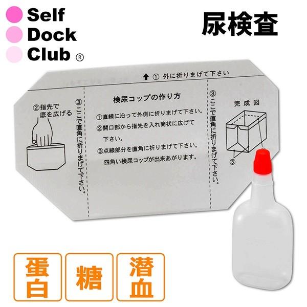 尿検査 3項目（尿糖・尿蛋白・尿潜血） 〜糖尿病や腎臓が心配な方