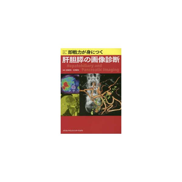 [Release date: April 1, 2023]著者：吉満研吾/石神康生出版社：メディカル・サイエンス・インターナショナ