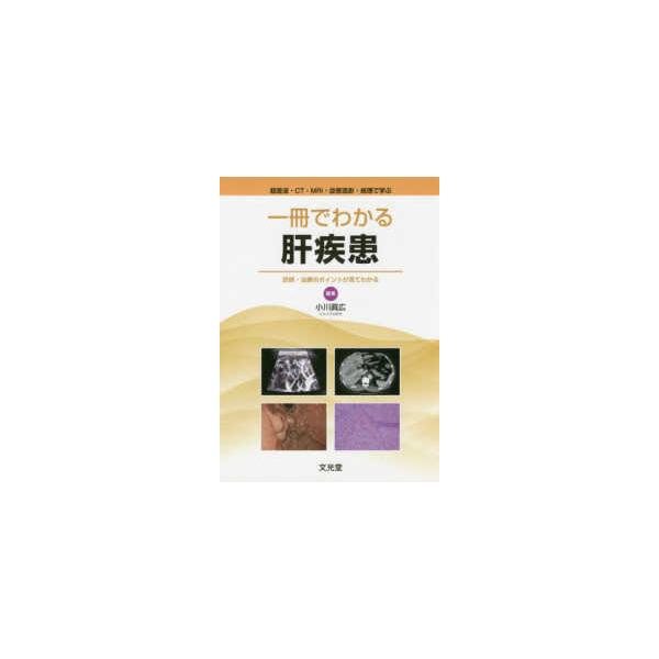 超音波・ＣＴ・ＭＲＩ・血管造影・病理で学ぶ　一冊でわかる肝疾患―診断・治療のポイントが見てわかる