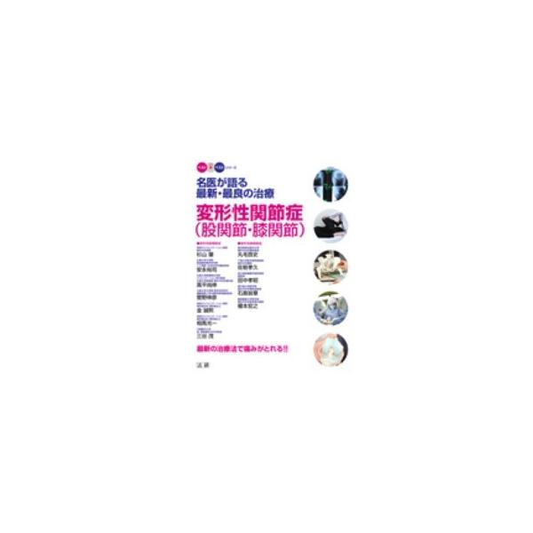 ベスト×ベストシリーズ 名医が語る最新・最良の治療 変形性関節症（股関節・膝関節）―最新の治療法で痛みがとれる！！