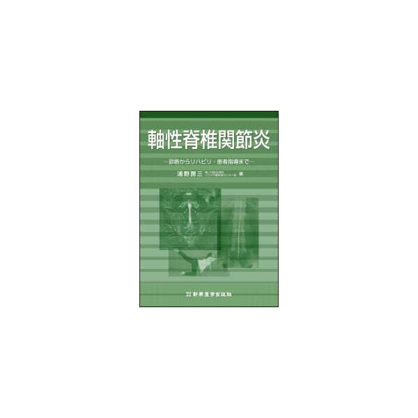軸性脊椎関節炎―診断からリハビリ・患者指導まで
