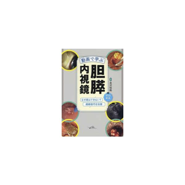 動画で学ぶ胆膵内視鏡―なぜ君はできない？超絶技巧を伝授