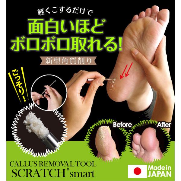 ■商品名：スクラッチスマート　角質削り 角質除去 フットケア 足裏<BR>■商品サイズ：（本体）7.5cm（黒スティック）9cm<BR>■個装サイズ：15.5×13×2.5cm<BR>■重量：33g&lt...