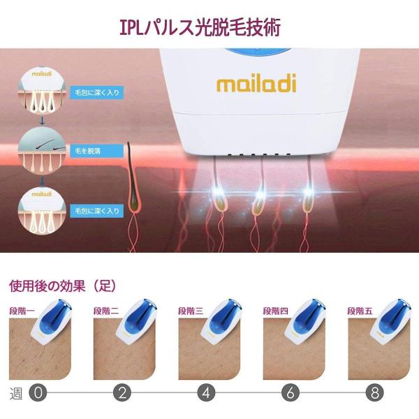 Mailadi 光脱毛器 永久脱毛 充電式ipl脱毛器 ダブル石英管 2倍脱毛効果 光美容器 永久脱毛 肌に優しい 美肌機能搭載 肌に優しい Krsストアのmailadi 自動連続照射 家庭用 Krsストア