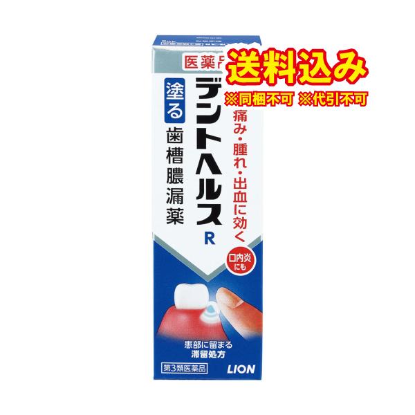 歯ぐきや歯周ポケットに指で塗り込む塗布タイプの歯肉炎、歯槽膿漏薬です。患部に塗りやすく，爽やかな使用感のゲルタイプです。