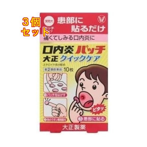 貼る口内炎治療薬です。口腔内ですぐれた付着力をもち、患部を刺激からしっかりカバーし、また、成分が持続的に作用します。