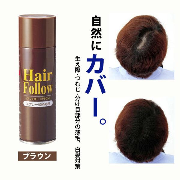 医薬部外品 育毛剤 つむじ 育毛剤 医薬部外品 の人気商品 通販 価格比較 価格 Com