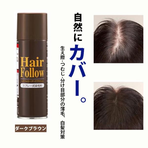 ヘアフォロー ダークブラウン 正規品 生え際 つむじはげ 分け目 薄毛をカバー 薄毛隠しスプレー Buyee Buyee Japanischer Proxy Service Kaufen Sie Aus Japan