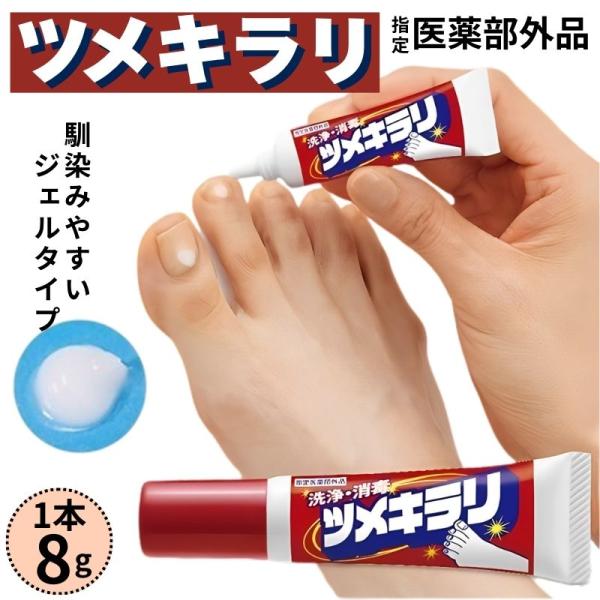 【商品名】ツメキラリ （外皮消毒剤）≪販売名≫薬用NCジェル【商品説明】「ツメキラリ」は、製薬会社が開発した指定医薬部外品の薬用ジェルです。ジェル状のため、爪やその周辺にしっかりとどまり、日常生活での爪のケアにお役立ていただけます。≪特長≫...