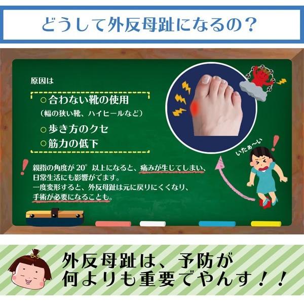 外反母趾サポーター 寝ながら外反母趾ケア 縁の下のおやすみ外反サポーター 日本製 矯正 補整 ケアベルト 痛み軽減 美脚 メッシュ 洗濯機ok 送料無料 Co Lifeone Yahoo 店 通販 Yahoo ショッピング