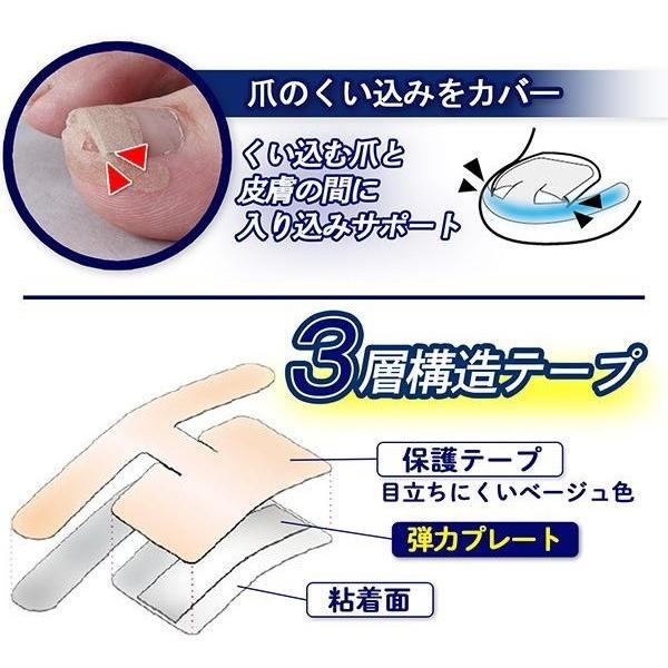 痛い巻き爪に 巻爪ケア 巻き爪ダブルケアテープ 60枚入 日本製 フットケア つめ 食い込み プレート内蔵 保護テープ 送料無料 Co Lifeone Yahoo 店 通販 Yahoo ショッピング