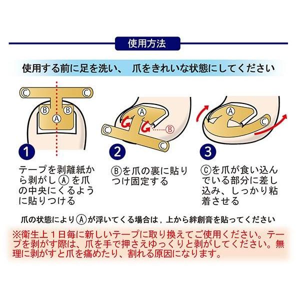 痛い巻き爪に 巻爪ケア 巻き爪ダブルケアテープ 60枚入 日本製 フットケア つめ 食い込み プレート内蔵 保護テープ 送料無料 Co Lifeone Yahoo 店 通販 Yahoo ショッピング