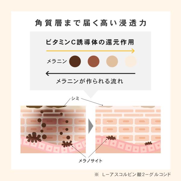 luire_txlwl2_7_d_20260113173032