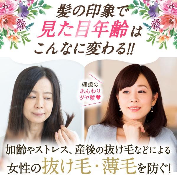 女性用 モンゴ流シャンプー Quiotil 350ml 育毛シャンプー 産後 薄毛 抜け毛スカルプケア フケ ノンシリコン 母の日 ギフト プレゼント Buyee Buyee Japanese Proxy Service Buy From Japan Bot Online