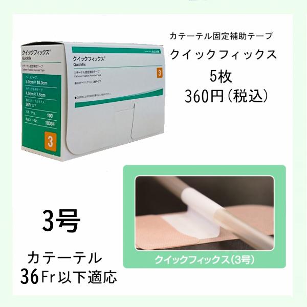 クイックフィックスは膀胱留置カテーテル、中心静脈カテーテル、末梢静脈点滴・輸液ルートのライン部処置に関して、従来粘着テープで行われてきた準備・加工・操作にかかる時間を軽減するための加工済テープです。クイックフィックスは体幹部用に設計しており...