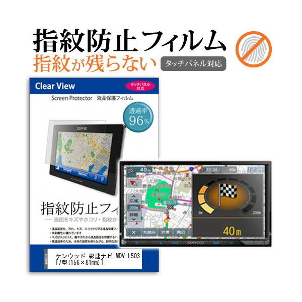 MDV-L503」の人気商品一覧 | 安い商品を通販サイトから探す