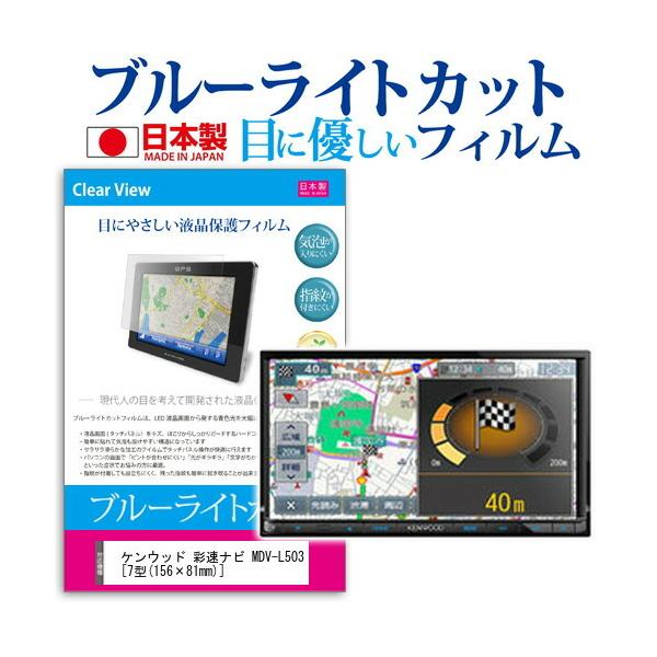 PEbh ʑir MDV-L503 u[CgJbg ˖h~ tیtB wh~ CAXH ttB ݊i