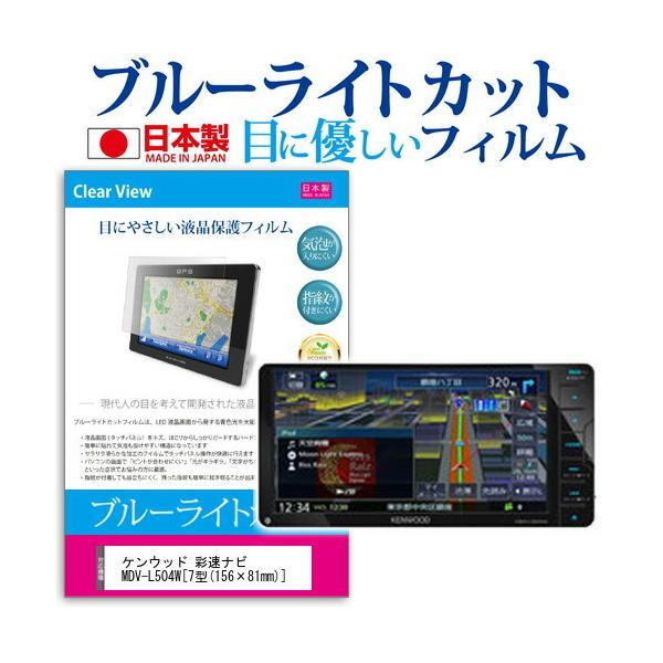 �P���E�b�h �ʑ��i�r MDV-L504W �u���[���C�g�J�b�g ���˖h�~ �t���ی�t�B���� �w��h�~ �C�A���X���H �t���t�B���� �݊��i