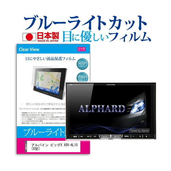 ApC rbOX X8V-AL10 u[CgJbg ˖h~ tیtB wh~ CAXH ttB ݊i