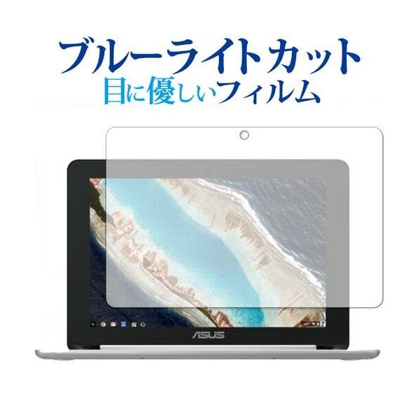 ASUS Chromebook Flip C101PA ��p �u���[���C�g�J�b�g ���˖h�~ �t���ی�t�B���� �w��h�~ �t���t�B���� �݊��i