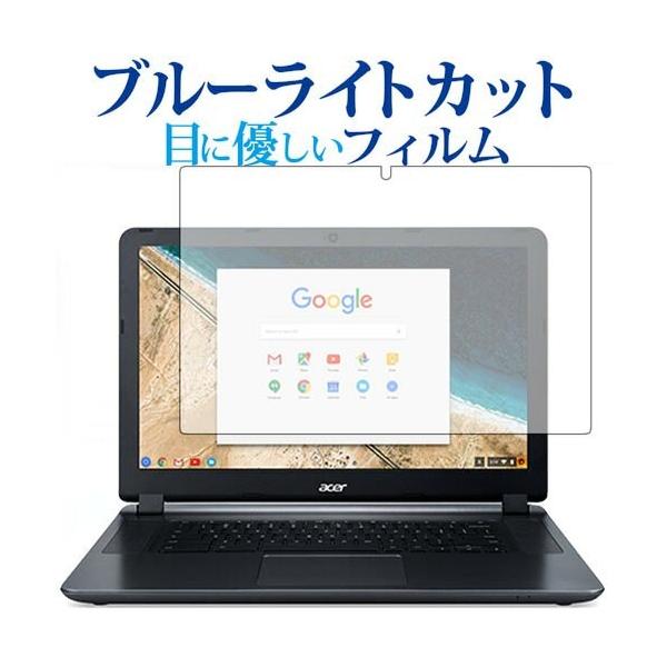 Chromebook Spin 11/Acer��p �u���[���C�g�J�b�g ���˖h�~ �t���ی�t�B���� �w��h�~ �t���t�B���� �݊��i