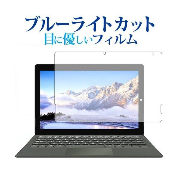 Teclast X5 Pro��p �u���[���C�g�J�b�g ���˖h�~ �t���ی�t�B���� �w��h�~ �t���t�B���� �݊��i