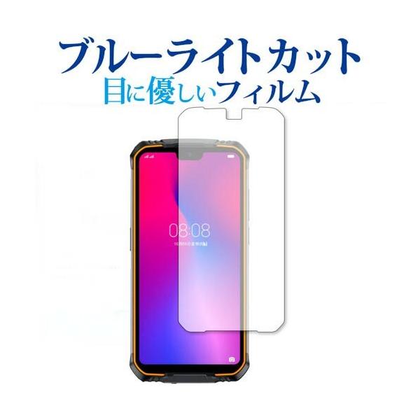 DOOGEE S68 Pro ��p �u���[���C�g�J�b�g ���˖h�~ �ی�t�B���� �w��h�~ �t���t�B���� ���[���֑������� �݊��i