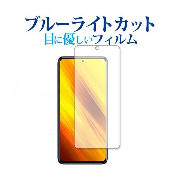 Xiaomi POCO X3 NFC p u[CgJbg ˖h~ یtB wh~ ݊i