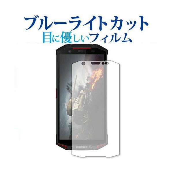 DOOGEE S70 / S70 Lite��p �u���[���C�g�J�b�g ���˖h�~ �t���ی�t�B���� �w��h�~ �t���t�B���� �݊��i