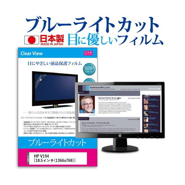 HP V194 (18.5C`) @Ŏg u[CgJbg ˖h~ tیtB wh~ CAXH ttB ݊i
