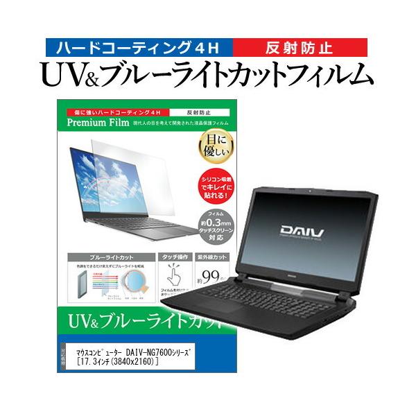 }EXRs[^[ DAIV-NG7600V[Y (17.3C`) @Ŏg u[CgJbg ˖h~ wh~ tیtB ݊i