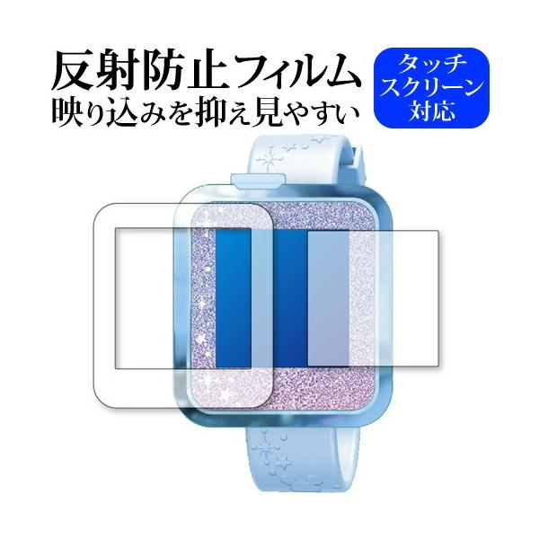 �f�B�Y�j�[���s�N�T�[�L�����N�^�[ �}�W�J���X�}�[�g�E�H�b�` ��p ���˖h�~ �m���O���A �t���ی�t�B���� �݊��i