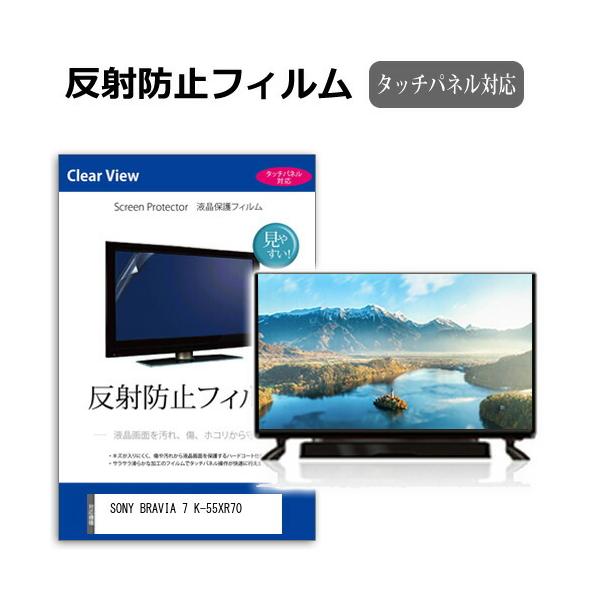 mediacover_mat-tv-k0001638766