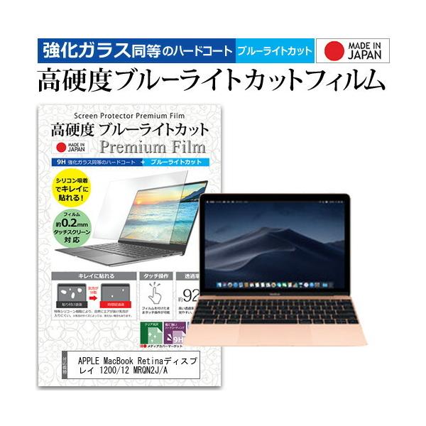 APPLE MacBook RetinafBXvC 1200/12 MRQN2J/A (12C`) @Ŏg KX dx9H u[CgJbg NA tیtB ݊i