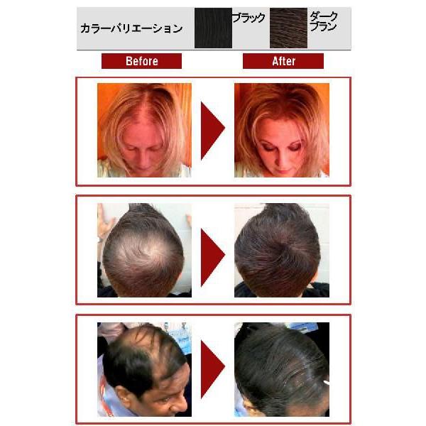 薄毛隠し薄毛対策ハゲ隠しヘアコンシーラーカボキ増毛25g 最大70回分使用可能 Buyee Buyee 提供一站式最全面最專業現地yahoo Japan拍賣代bid代拍代購服務