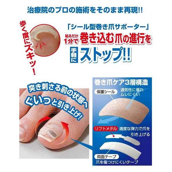 巻き爪の治し方 自分で ワイヤー クリップ 器具 テーピング テープ ロボ フットケア 日本製 口コミ 巻き爪シール1ヶ月ケア Buyee Buyee 日本の通販商品 オークションの代理入札 代理購入