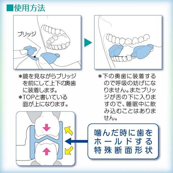 いびき 治し方 グッズ 防止 いびきをかかない方法 マウスピース 不眠 口呼吸 女性 男性 口コミ 対策 いびきくん Buyee Buyee Japanese Proxy Service Buy From Japan Bot Online