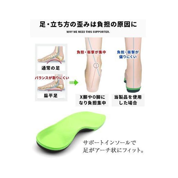 X脚 インソール 矯正 みんな探してる人気モノ X脚 インソール 矯正 靴