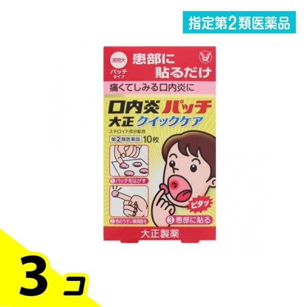 使用期限は6カ月以上先のものを送ります。ステロイド成分「トリアムシノロンアセトニド」を配合した'貼る'口内炎治療薬。口腔内ですぐれた付着力をもち，患部を刺激からしっかりカバーし，ステロイド成分が持続的に作用。