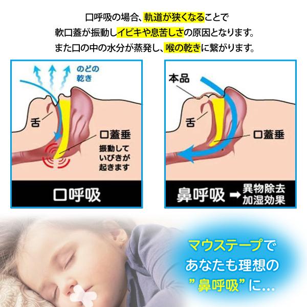 いびき防止 マウステープ 口閉じテープ 複数購入 大幅値下げ いびき対策 鼻呼吸 喉 口 乾燥対策 防止 送料無料 Buyee Buyee Japanese Proxy Service Buy From Japan Bot Online