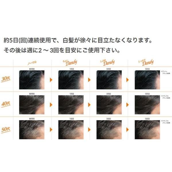 白髪染め Hoyu ホーユー レセ Gx カラーリンス メンズ 白髪染め ナチュラルブラック 160g Buyee Buyee Japanese Proxy Service Buy From Japan Bot Online