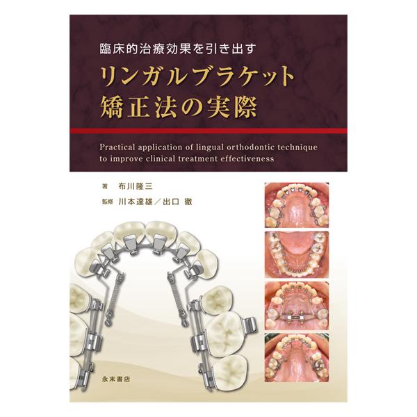 ♪裁断済 臨床的治療効果を引き出す リンガルブラケット矯正法の実際 nagasueshoten_kyosei09
