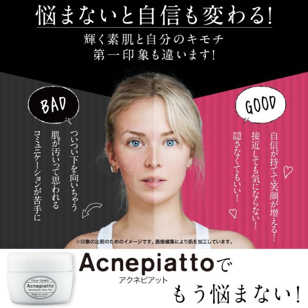 美白 ニキビケア アクネピアット オールインワン 美白ゲルクリーム これ1つで化粧水 保湿ジェル マッサージジェルなど様々な役割 トータルサポート 4箱 2g Buyee Buyee 日本の通販商品 オークションの代理入札 代理購入